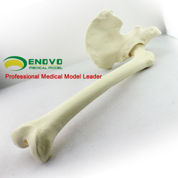 SIMULACIÓN MAYORISTA HUESO 12314 Anatomía Médica Cadera Artificial con Hueso Fémur, Ortopedia Práctica Simulación Hueso